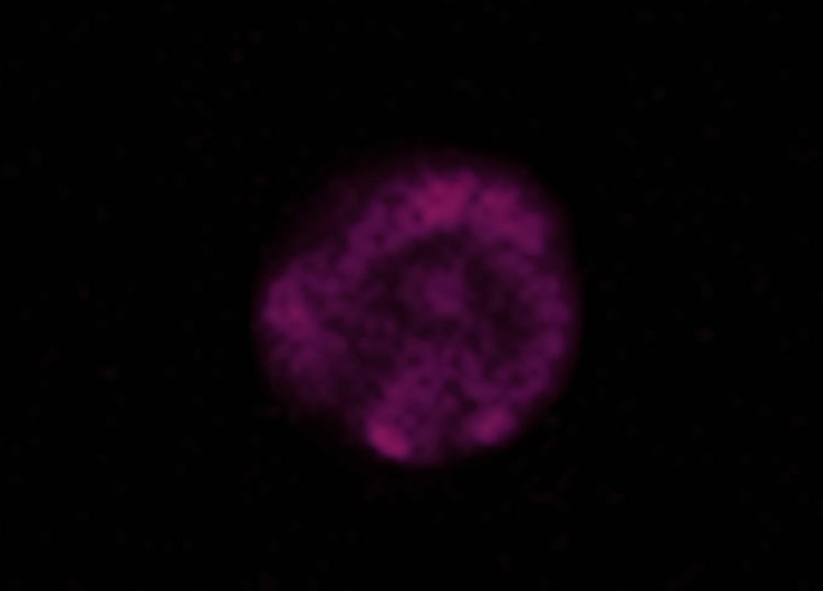 تصویر پرتوایکس از ابرتواختر SNR 0519 در انرژی زیاد
